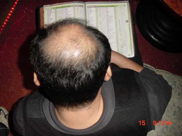 ��ſ� �ð� �Ǽ���